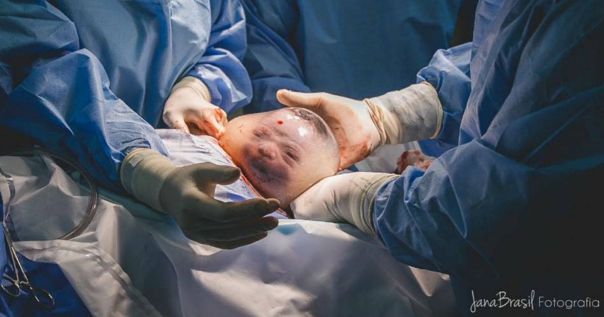 Pogledajte nevjerojatne fotografije bebe koja je na svijet stigla u vodenjaku